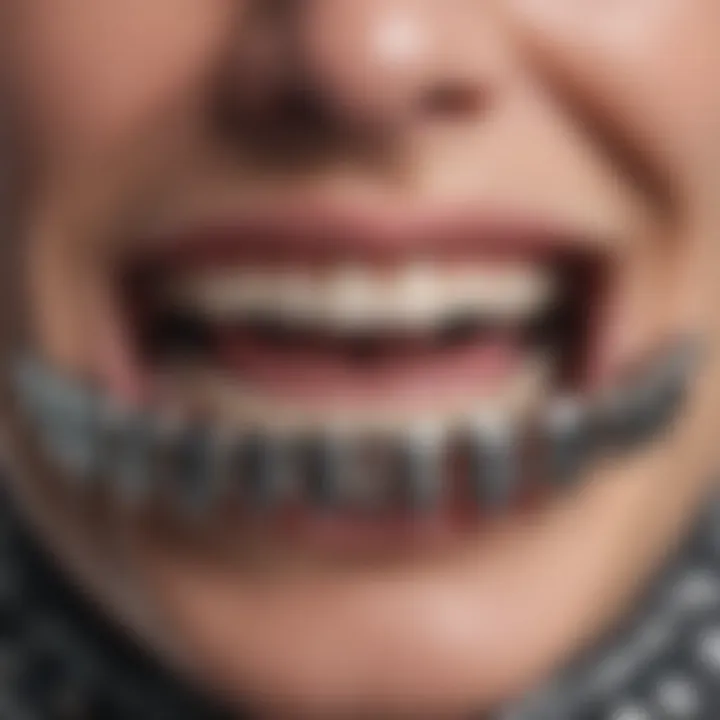 A close-up view of traditional metal braces on teeth.