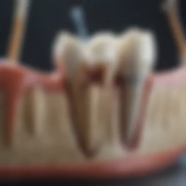 Common myths about root canals debunked