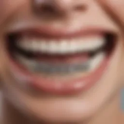 A detailed view of lower teeth braces highlighting their structure.