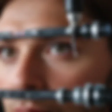 Overview of the LASIK Procedure LASIK eye surgery procedure overview
