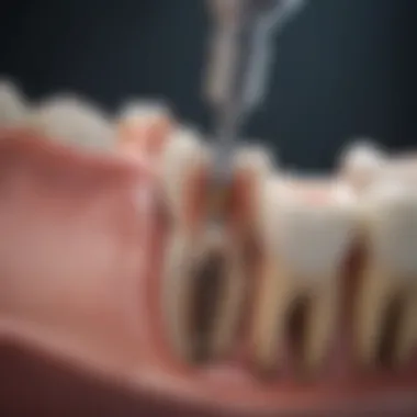 Detailed overview of root canal treatment