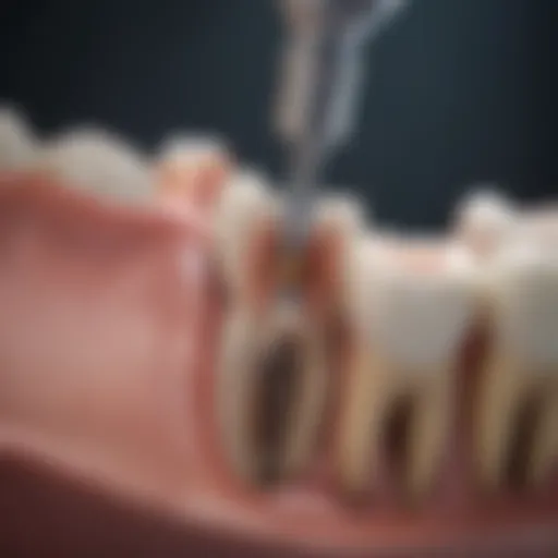 Detailed overview of root canal treatment